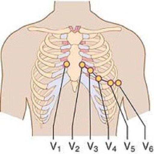 Clinical ECG Guide. 2.1.2.AZ