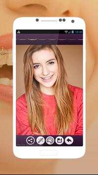 Braces Teeth Photo Editor screenshot 3