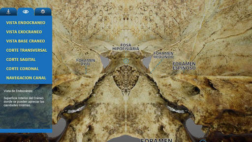 UC MedApp Craneo 3D screenshot 4