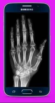 X X Ray Scanner App Prank screenshot 3