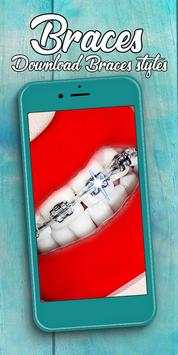 Braces screenshot 12