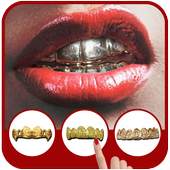 Gold Teeth Grillz 2.0
