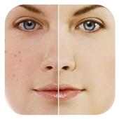 Photo Editor Blemish logo
