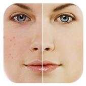 Photo Editor Blemish 1.0