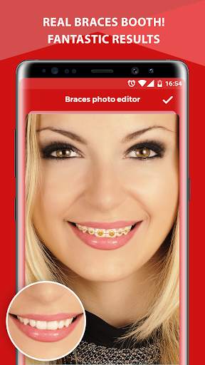 Braces Photo Editor screenshot 5