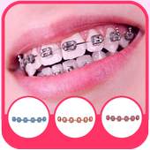 Real Braces teeth 5.0