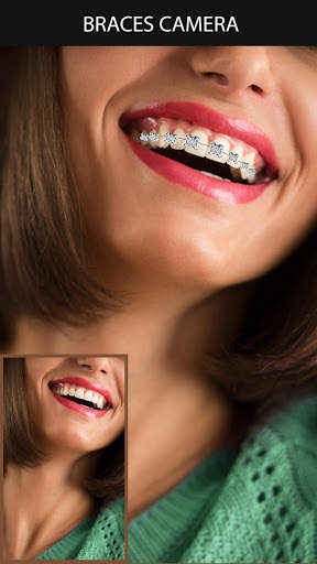 Braces Camera screenshot 1