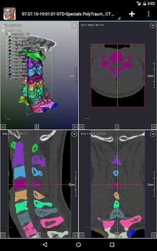 DroidRender - 3D DICOM viewer स्क्रीनशॉट 10