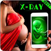 Pregnant Ultrasound Scan Prank 1.0.1