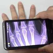 Xray Scanner icon