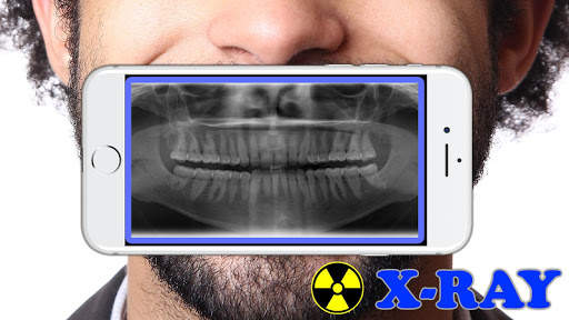 X-Ray Filter Photo screenshot 2