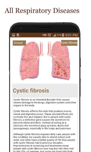 All Respiratory Disease and Treatment screenshot 10