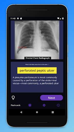 Basic Radiology for medical students screenshot 3