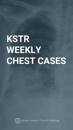 KSTR Weekly Chest Cases screenshot 1