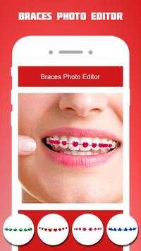 Braces Photo Editor 2018 screenshot 2