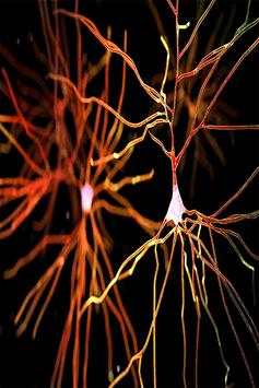 Dopamine screenshot 2