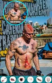 Injury Photo Editor скриншот 6