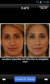 Plastic Surgery w/ Dr. Vitenas screenshot 2