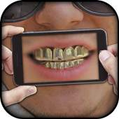 Gold Teeth Photo Editor 1.0