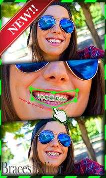 Braces Teeth Camera 2 تصوير الشاشة