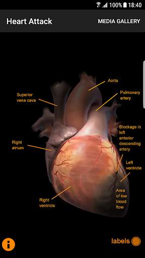 CardioSmart Heart Explorer screenshot 4
