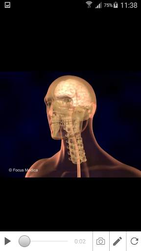 Stroke screenshot 3