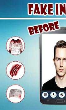 Fake Injuries Photo Editor 2019-Injury Marks Maker screenshot 1