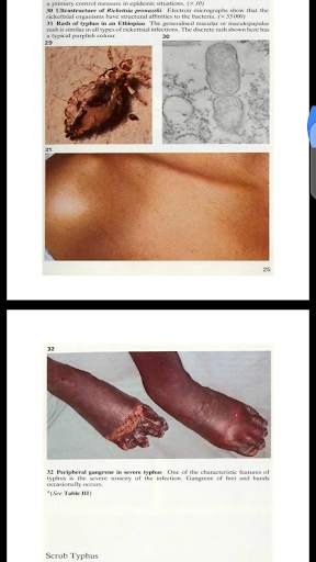 Atlas Of Tropical Medicine And Parasitology screenshot 2