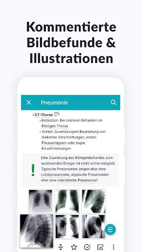AMBOSS Wissen für Mediziner screenshot 7