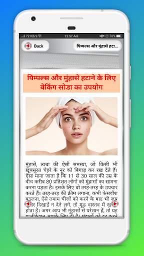 pimple hatane ke upay ~ पिंपल हटाने के उपाय screenshot 7