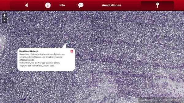 Smart Hematology Lite screenshot 11