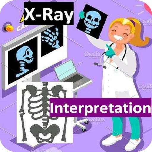 X-Ray Interpretation 4.5