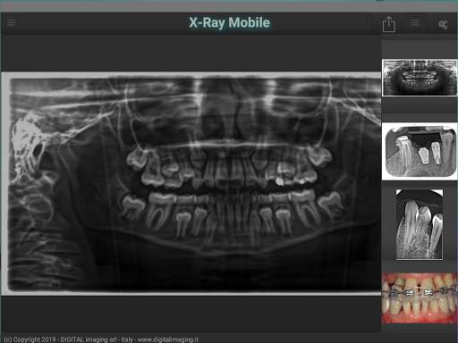 X-Ray Mobile screenshot 1