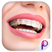 Braces Teeth Photo Editor icon