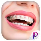 Braces Teeth Photo Editor 1.0