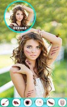 Injury Photo Editor скриншот 8