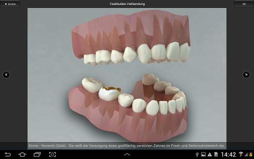 CGM VISODENT 3D App screenshot 3