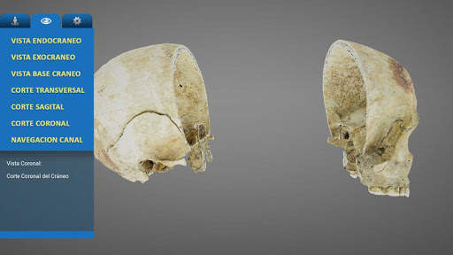 UC MedApp Craneo 3D screenshot 7