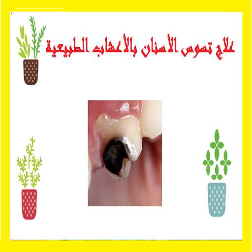 علاج تسوس الأسنان بالأعشاب الطبيعية 1.0.1
