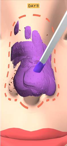 Nose Clean screenshot 3