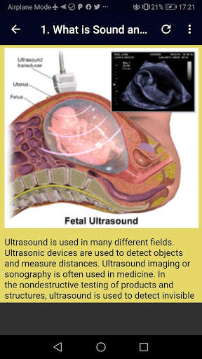 Ultrasound Complete Guide screenshot 3