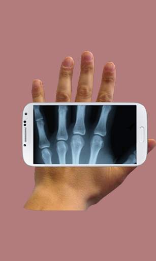X-ray Cam Prank screenshot 2