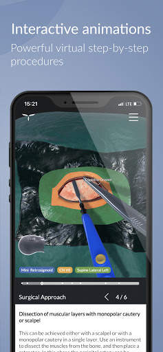 UpSurgeOn Neurosurgery screenshot 4