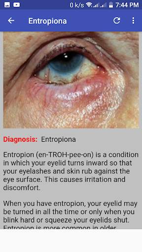 Ophthalmology & Optometry Guide screenshot 4