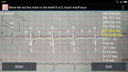 ECG Reader free screenshot 2