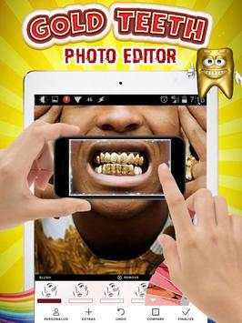 Gold Teeth Photo Editor screenshot 2