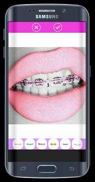 Top Design Braces teeth screenshot 1