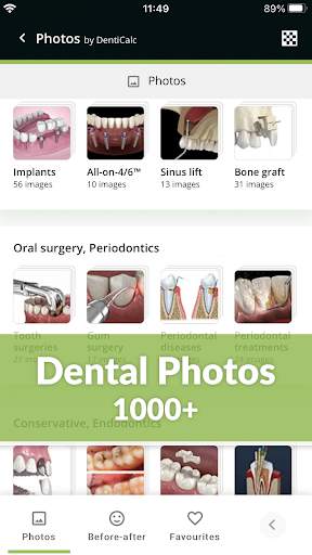 DentiCalc 4in1: Dental Care Tool for Dentists screenshot 2