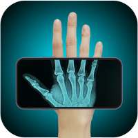 Xray Scan Body Scanner Camera
