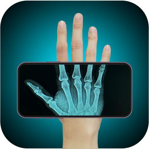 Xray Scan Body Scanner Camera 1.0
